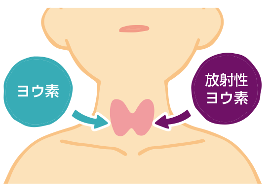 甲状腺とヨウ素